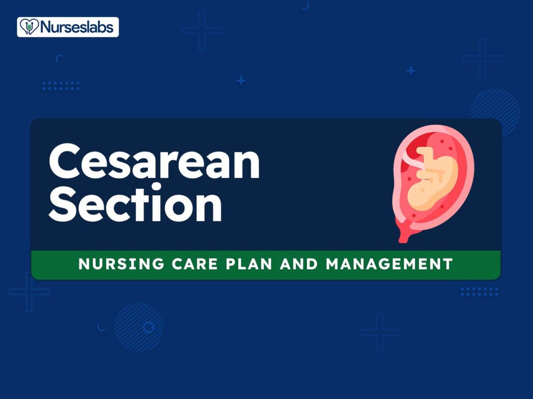 LTCS Medical Abbreviation Pregnancy: Your Complete Guide to a Lower Segment Cesarean Section